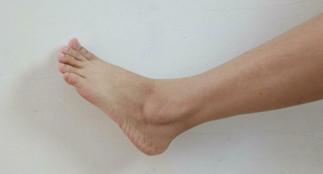 Ingrown toenail causes and treatment