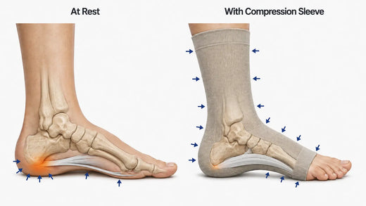 How do Compression Socks Help Plantar Fasciitis?