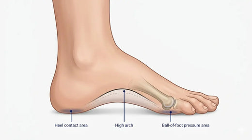 Do Orthotic Insoles Help If You Have High Arches?