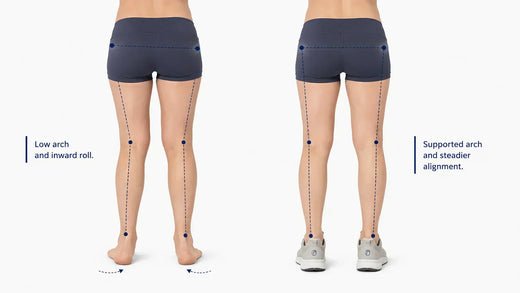 Can Flat Feet Cause Back Pain? What the Foot-to-Back Connection Means