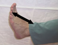 Good News for Flatfoot Sufferers