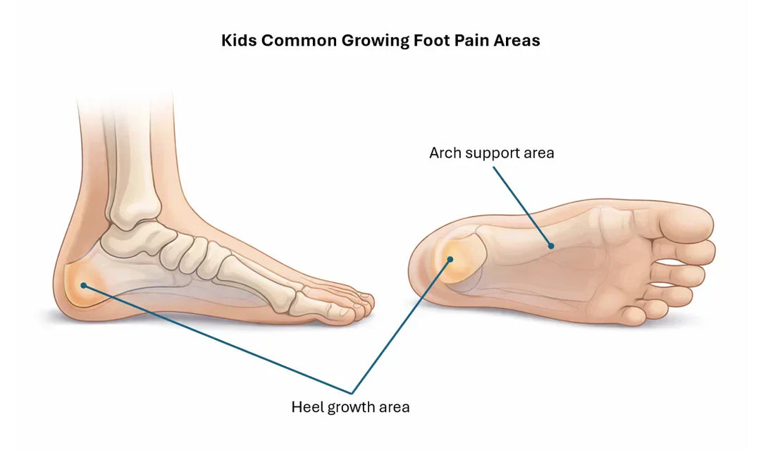 Understanding Growing Pains in Children’s Feet