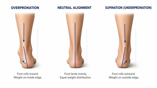 Supination vs. Overpronation: How to Tell Which One You Have