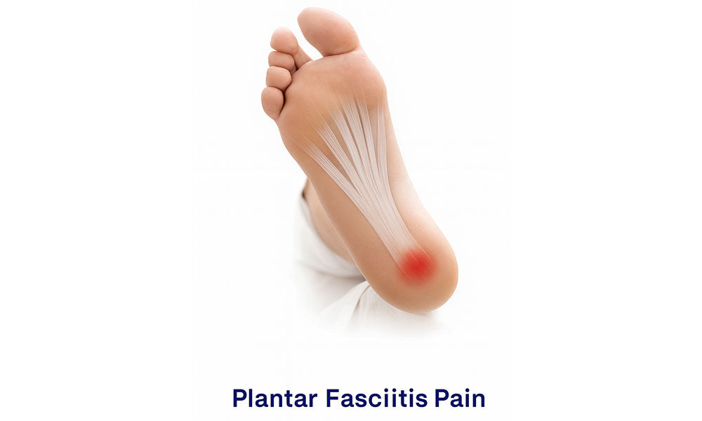 Footminders: Plantar Fasciitis Relief & Foot Care