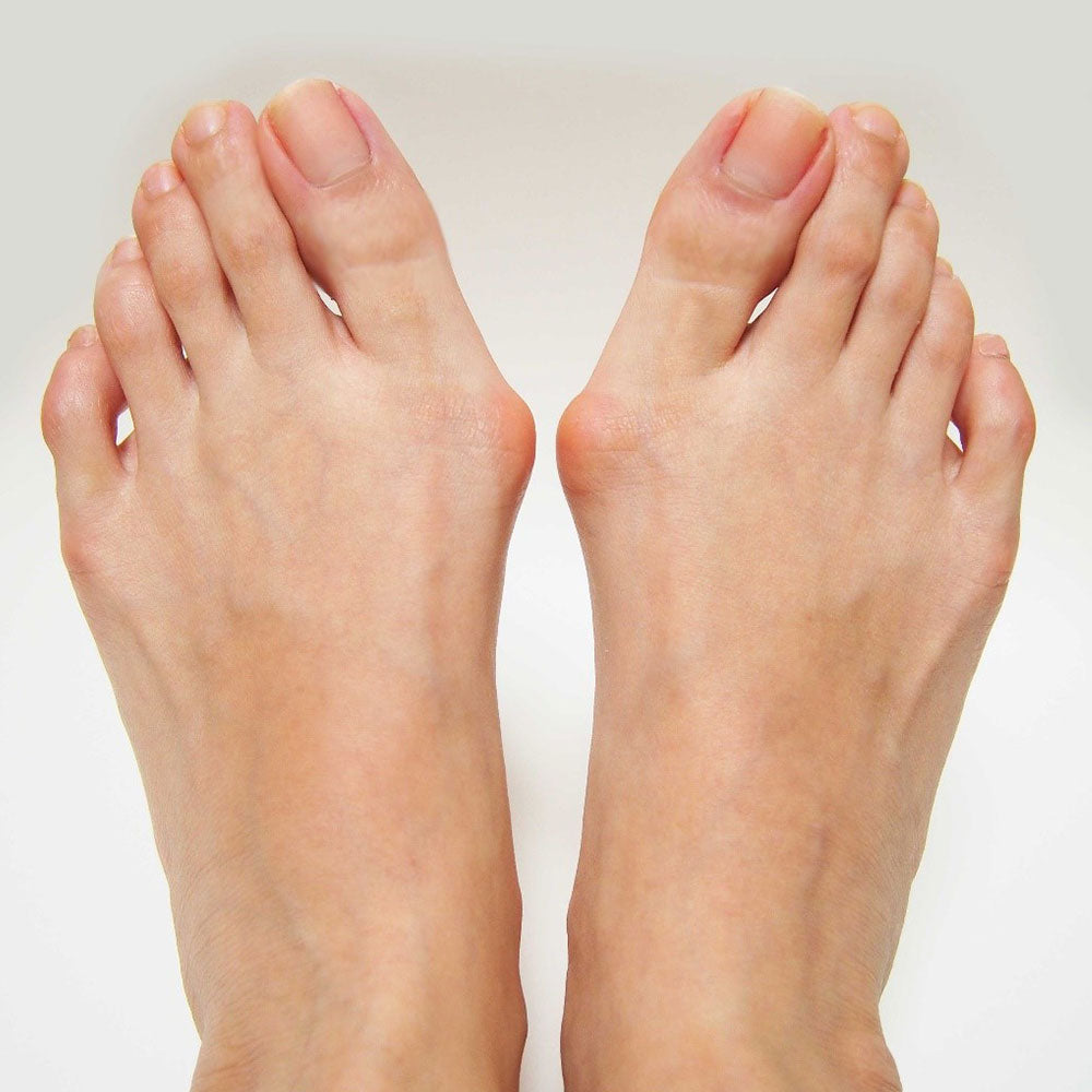 Plantar Fasciitis Exercises