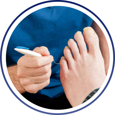 diabetic foot care