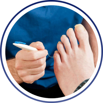 diabetic foot care