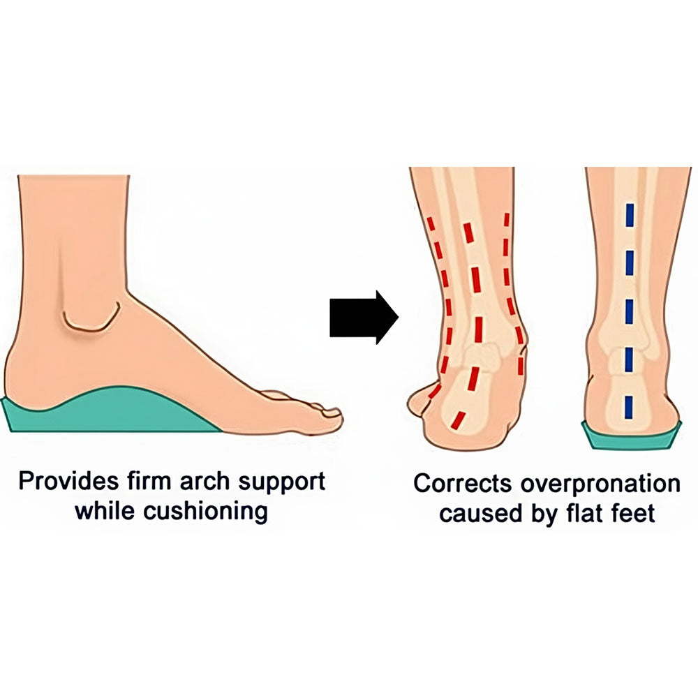 Illustration of feet with arch support showing benefits for flat feet and overpronation.