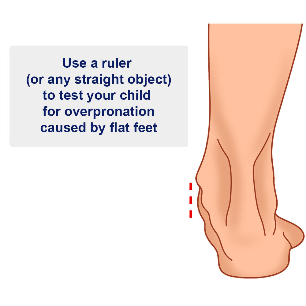 Illustration of a foot with text on how to test for overpronation using a ruler.