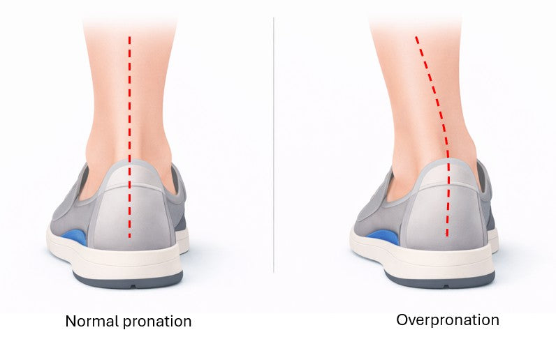 What outside heel wear really means