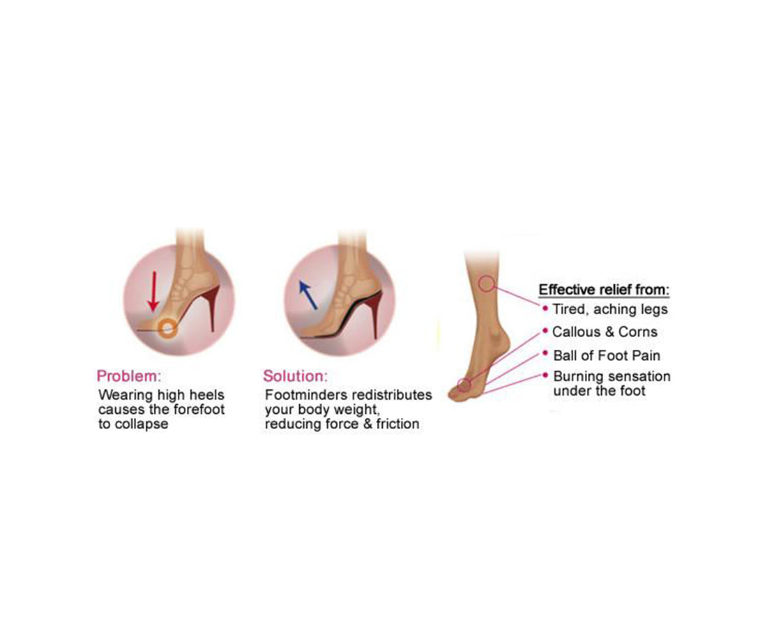 Footminders CATWALK - Orthotic arch support